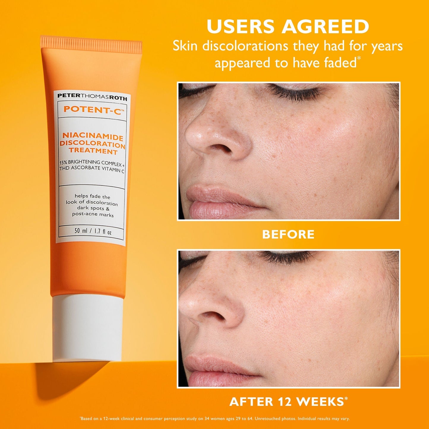 Potent-C Niacinamide Discoloration Treatment | 50 ml/1.7 fl oz