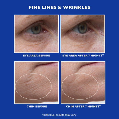 Retinol Fusion PM Night Serum|1.0 fl oz